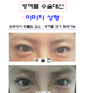이미지 성형