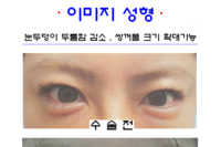 이미지 성형