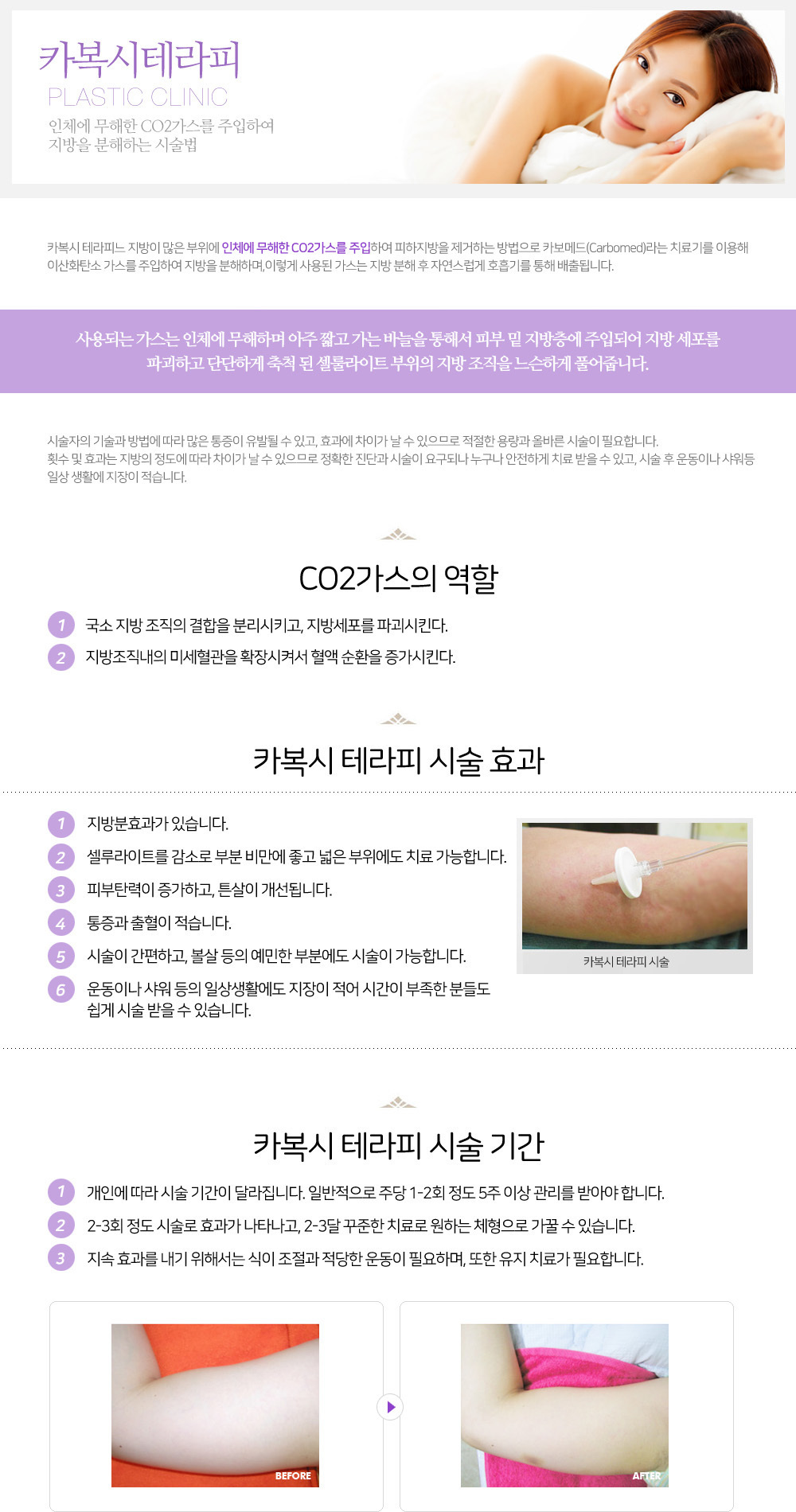 이미지명