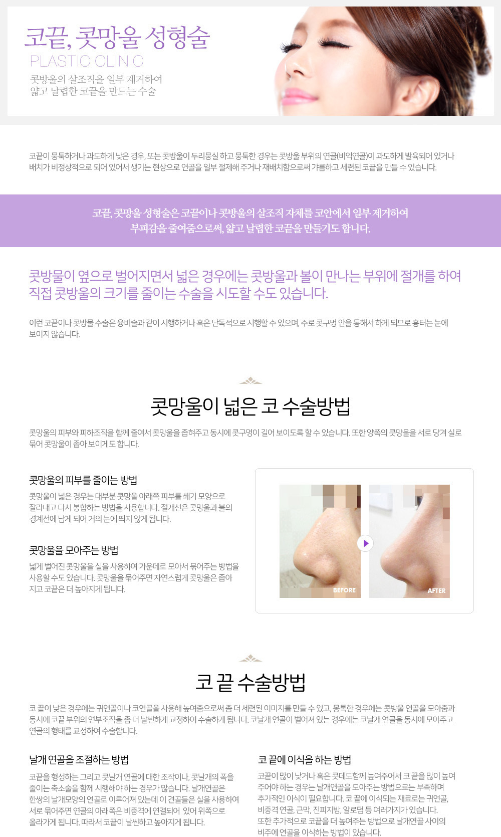 이미지명
