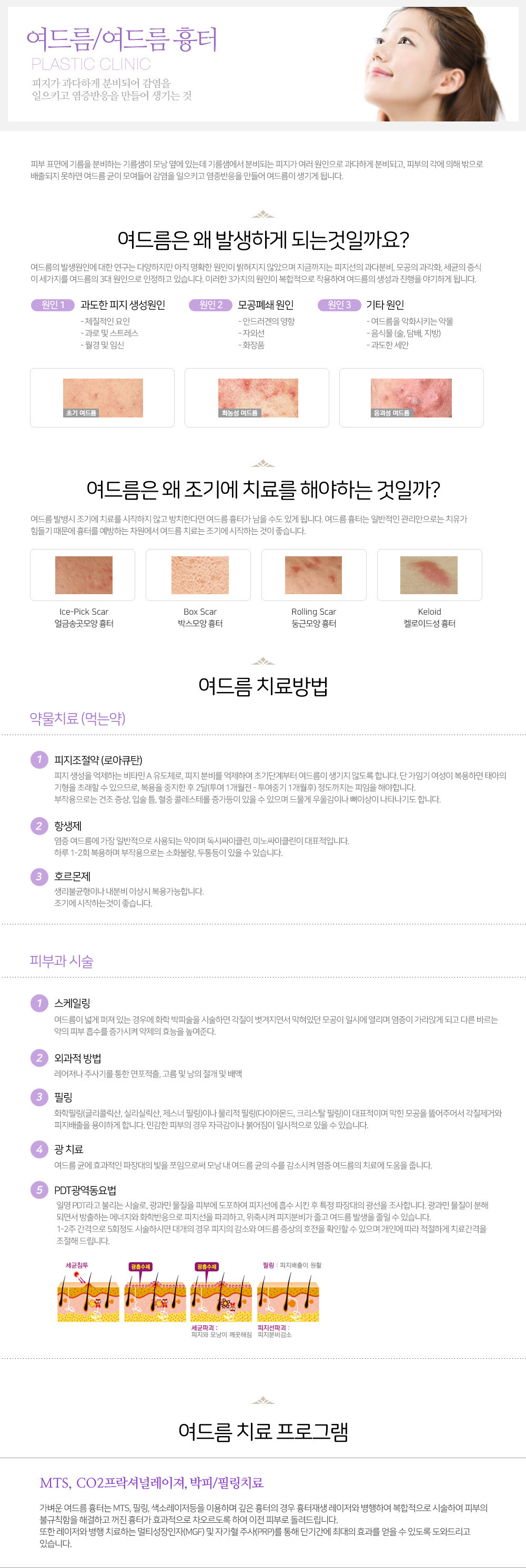 이미지명