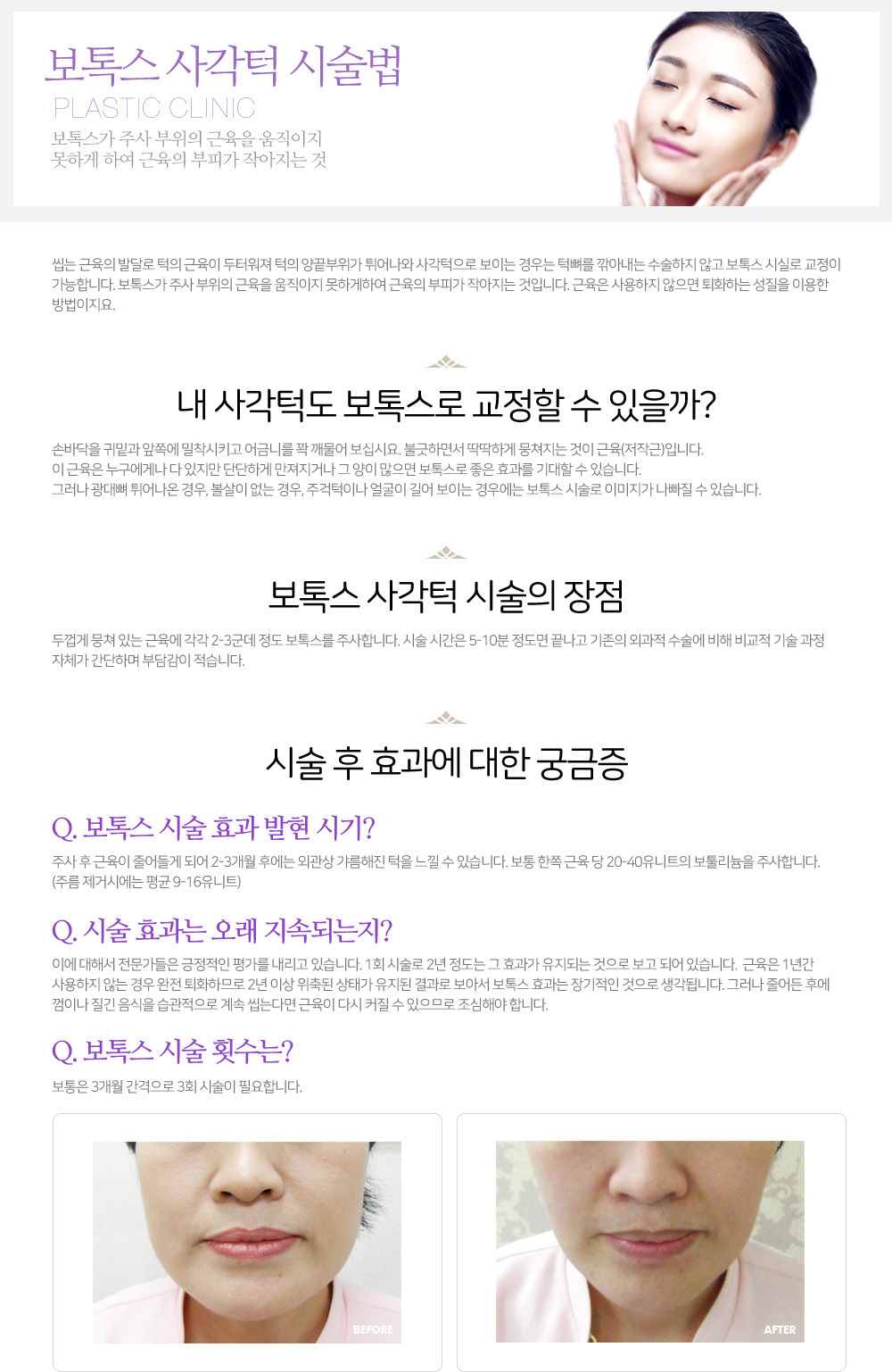 이미지명