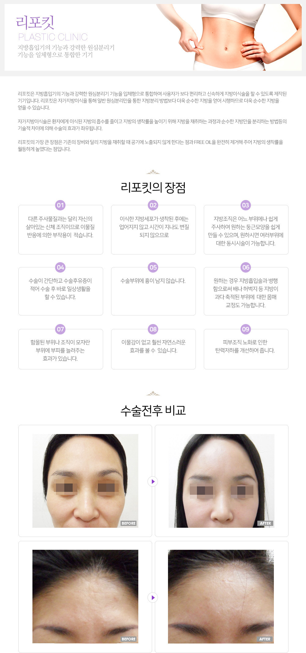 이미지명