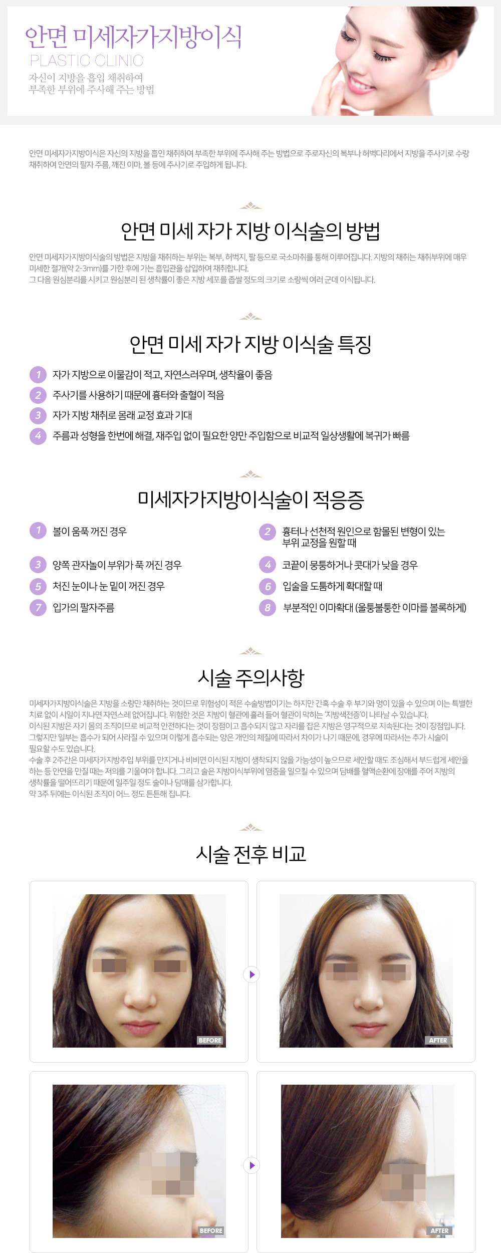 이미지명